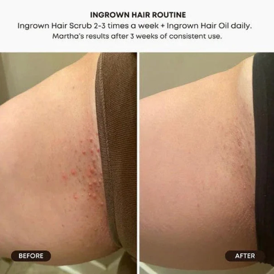 BushBalm - Watermelon Sugar Ingrown Hair Exfoliating Scrub